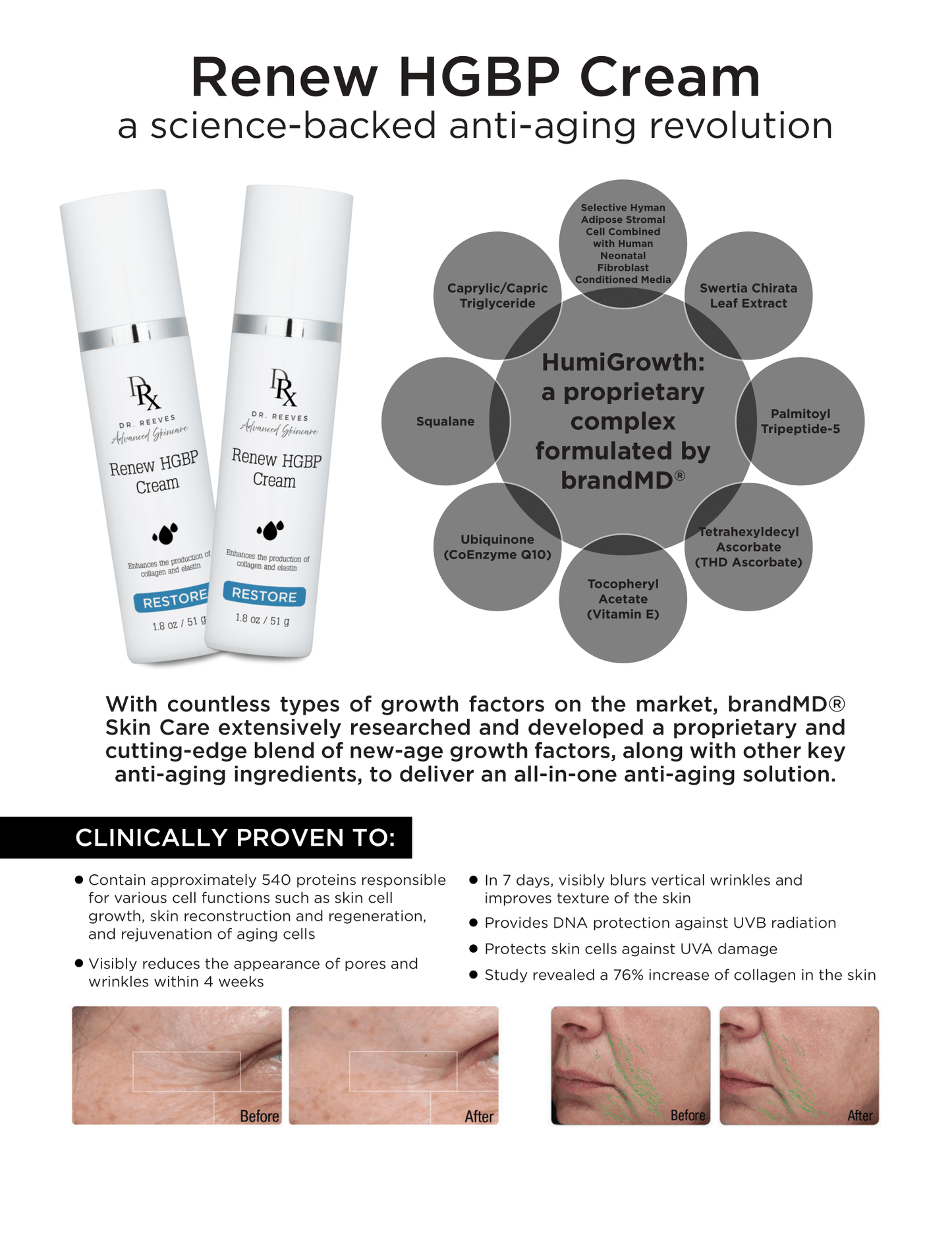 Renew HGBP Cream